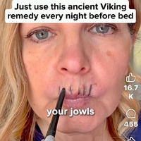 Social Media post about Viking remedies